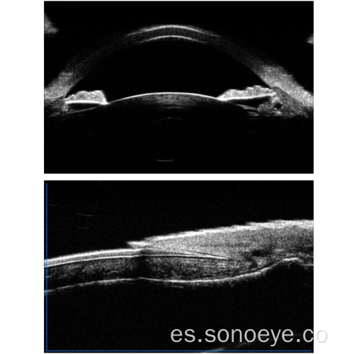 Microscopio de biomicroscopia ultrasonido para los ojos.